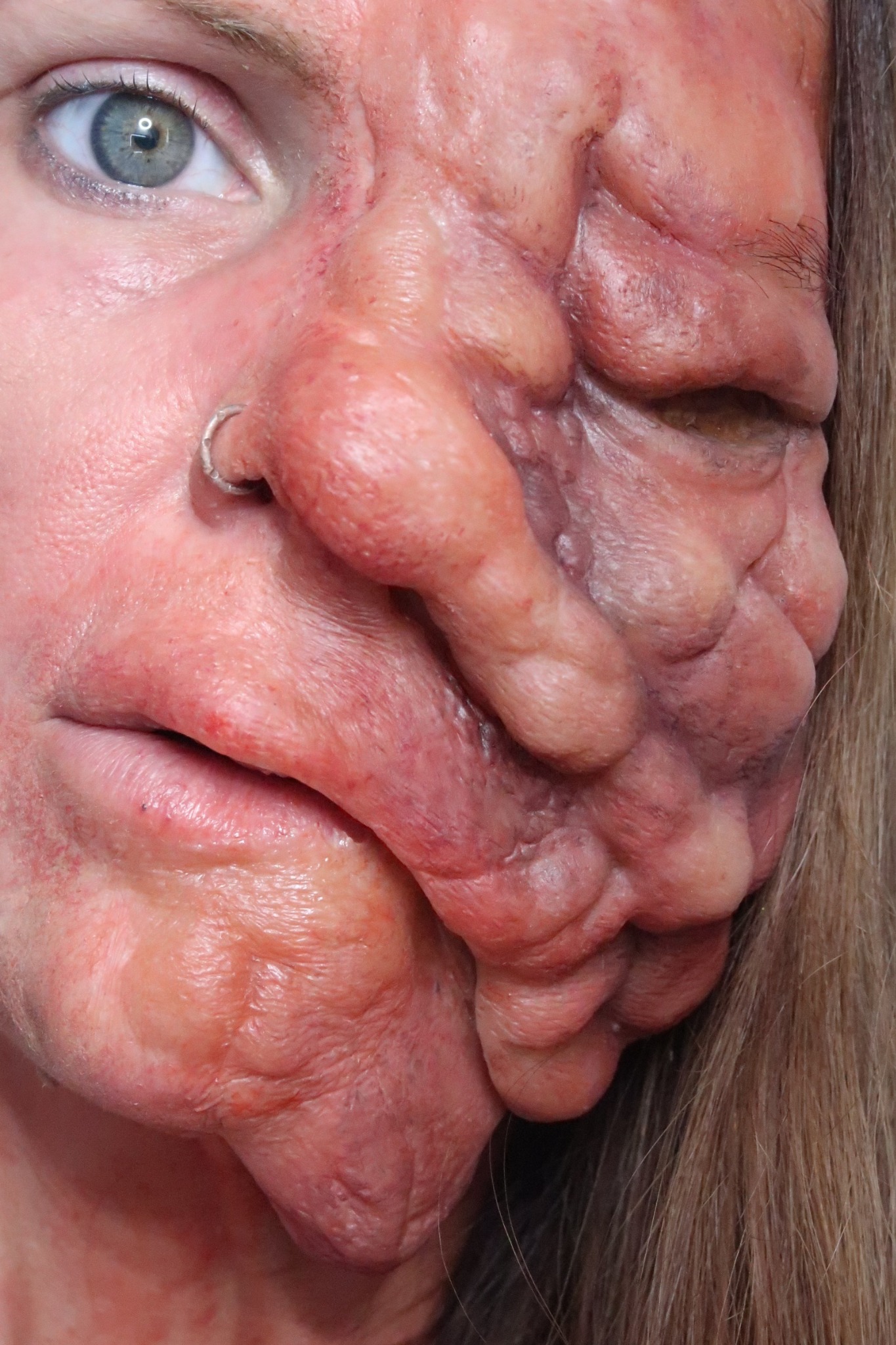 Detailed facial prosthetic SFX makeup created by Kellie Carpenter